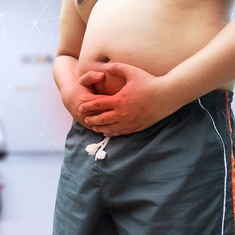 obesity - cancer - Dr Wael shalaan best obesity surgery in egypt