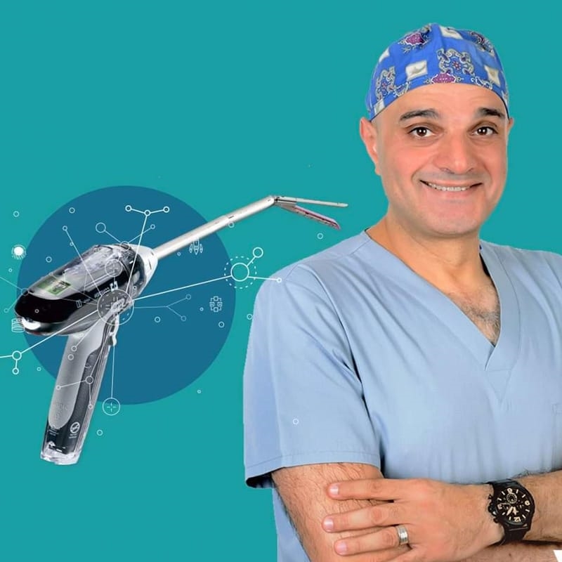 Smart Stapler - Dr Wael shalaan best obesity surgery in egypt