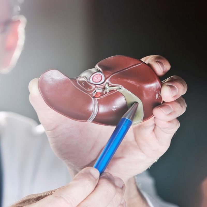 Gall Bladder and Bile duct Surgeries - Dr wael shalaan best obesity surgery
